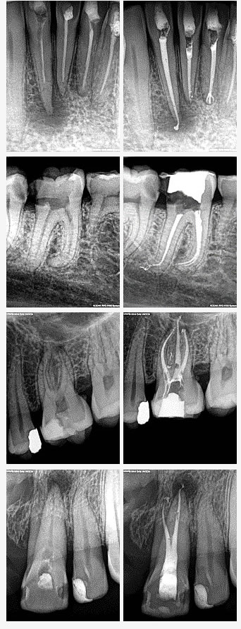 Endodontic referrals